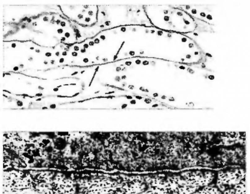 Строение и функции базальной мембраны. Строение и роль базафильной мембраны Темная пластинка базальной мембраны эпителиальных тканей содержит